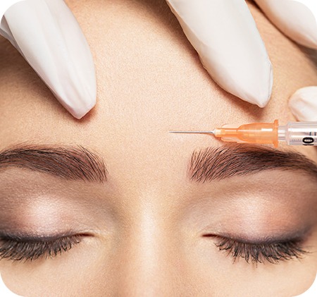 Brow Lift